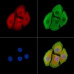 ALDH3B2 Antibody in Immunocytochemistry (ICC/IF)