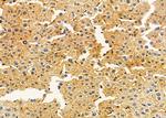 ALDH3B2 Antibody in Immunohistochemistry (Paraffin) (IHC (P))