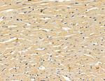 ALDH3B2 Antibody in Immunohistochemistry (Paraffin) (IHC (P))