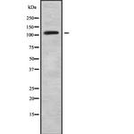 SLC4A9 Antibody in Western Blot (WB)