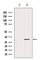 Aquaporin 11 Antibody in Western Blot (WB)