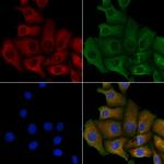 HACE1 Antibody in Immunocytochemistry (ICC/IF)