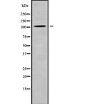 HACE1 Antibody in Western Blot (WB)