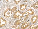 HLA-DQB2 Antibody in Immunohistochemistry (Paraffin) (IHC (P))