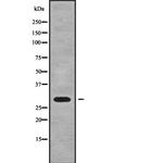 HLA-DQB2 Antibody in Western Blot (WB)