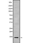 NMB Antibody in Western Blot (WB)