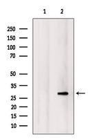 NOL7 Antibody in Western Blot (WB)