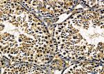 GPLD1 Antibody in Immunohistochemistry (Paraffin) (IHC (P))