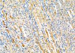 RAB1B Antibody in Immunohistochemistry (Paraffin) (IHC (P))