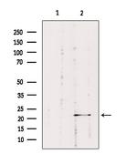 RAB1B Antibody in Western Blot (WB)