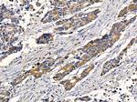 RAB21 Antibody in Immunohistochemistry (Paraffin) (IHC (P))