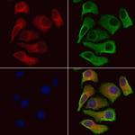 SLC4A7 Antibody in Immunocytochemistry (ICC/IF)