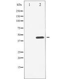 Phospho-Chk1 (Ser296) Antibody in Western Blot (WB)