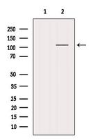 HDAC7 Antibody in Western Blot (WB)