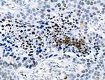 Phospho-CD227 (Mucin 1) (Tyr1229) Antibody in Immunohistochemistry (Paraffin) (IHC (P))
