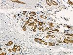 TNFAIP8 Antibody in Immunohistochemistry (Paraffin) (IHC (P))