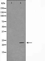 TNFAIP8 Antibody in Western Blot (WB)