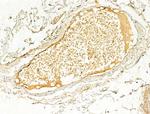 Phospho-ERK1/ERK2 (Thr202, Tyr204) Antibody in Immunohistochemistry (Paraffin) (IHC (P))