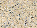 CCR7 Antibody in Immunohistochemistry (Paraffin) (IHC (P))