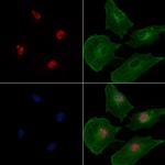 FOXO1/FOXO3/FOXO4 Antibody in Immunocytochemistry (ICC/IF)