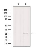 ASF1B Antibody in Western Blot (WB)