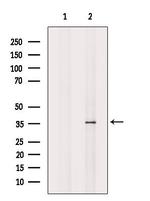 VN1R3 Antibody in Western Blot (WB)