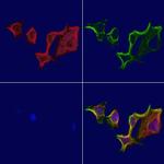 ATP Synthase beta Antibody in Immunocytochemistry (ICC/IF)