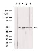 ATP Synthase beta Antibody in Western Blot (WB)