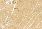 ATP Synthase beta Antibody in Immunohistochemistry (Paraffin) (IHC (P))