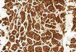 ATP Synthase beta Antibody in Immunohistochemistry (Paraffin) (IHC (P))