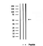 GSDMD Antibody in Western Blot (WB)