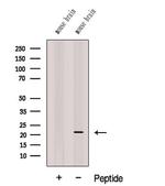 CPLX3 Antibody in Western Blot (WB)