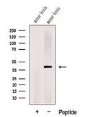 DNAJB12 Antibody in Western Blot (WB)
