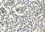 CA13 Antibody in Immunohistochemistry (Paraffin) (IHC (P))