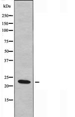 RASL10B Antibody in Western Blot (WB)