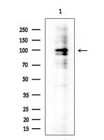 XPB Antibody in Western Blot (WB)
