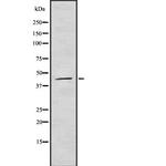 Varicella zoster Virus (strain Dumas) Antibody in Western Blot (WB)