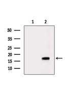 UBE2A/UBE2B Antibody in Western Blot (WB)