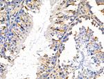 MMP14 Antibody in Immunohistochemistry (Paraffin) (IHC (P))