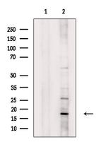 ECRG4 Antibody in Western Blot (WB)
