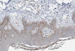 COL14A1 Antibody in Immunohistochemistry (Paraffin) (IHC (P))