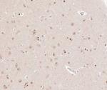 CKS2 Antibody in Immunohistochemistry (Paraffin) (IHC (P))