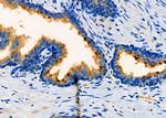 CKS2 Antibody in Immunohistochemistry (Paraffin) (IHC (P))