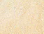 Phospho-ULK1 (Ser317) Antibody in Immunohistochemistry (Paraffin) (IHC (P))