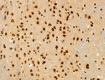 Phospho-RUNX1 (Ser249) Antibody in Immunohistochemistry (Paraffin) (IHC (P))