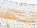 Phospho-ATG14 (Ser29) Antibody in Immunohistochemistry (Paraffin) (IHC (P))