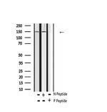 Phospho-FLT3 (Tyr969) Antibody in Western Blot (WB)