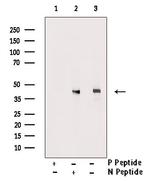 Phospho-LAT (Tyr200) Antibody in Western Blot (WB)