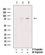 Phospho-PKMYT1 (Ser83) Antibody in Western Blot (WB)