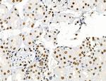 Phospho-SKP2 (Ser64) Antibody in Immunohistochemistry (Paraffin) (IHC (P))